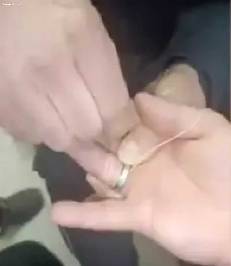 Adıyaman'da parmağına sıkışan yüzüğü itfaiye ekipleri çıkardı